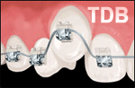 Système d’Orthodontie Damon