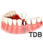 classique implant des dents bangkok thailand