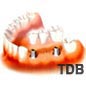 2 implant + 3 unit de Bridges bangkok thailand