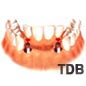 2 implant + 4 unit de Bridges bangkok thailand