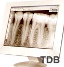 Kodak RVG 6000 rayons X dentaires