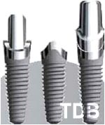 NobelPerfect implants